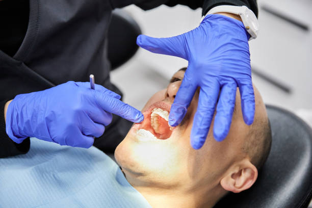 Best Emergency Tooth Extraction in Fremont, NC